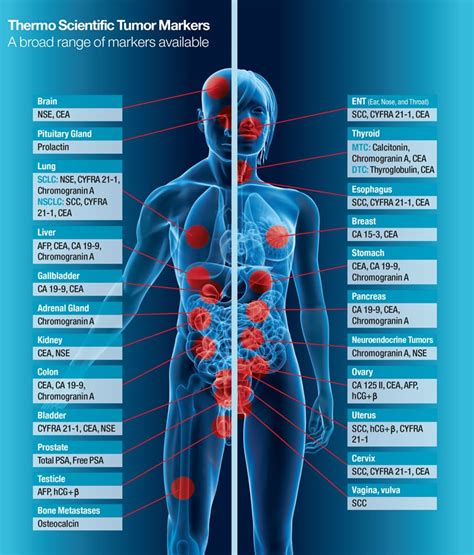 marker tumoral plamani|Markeri tumorali: tipuri, diagnostic, cancer asociat